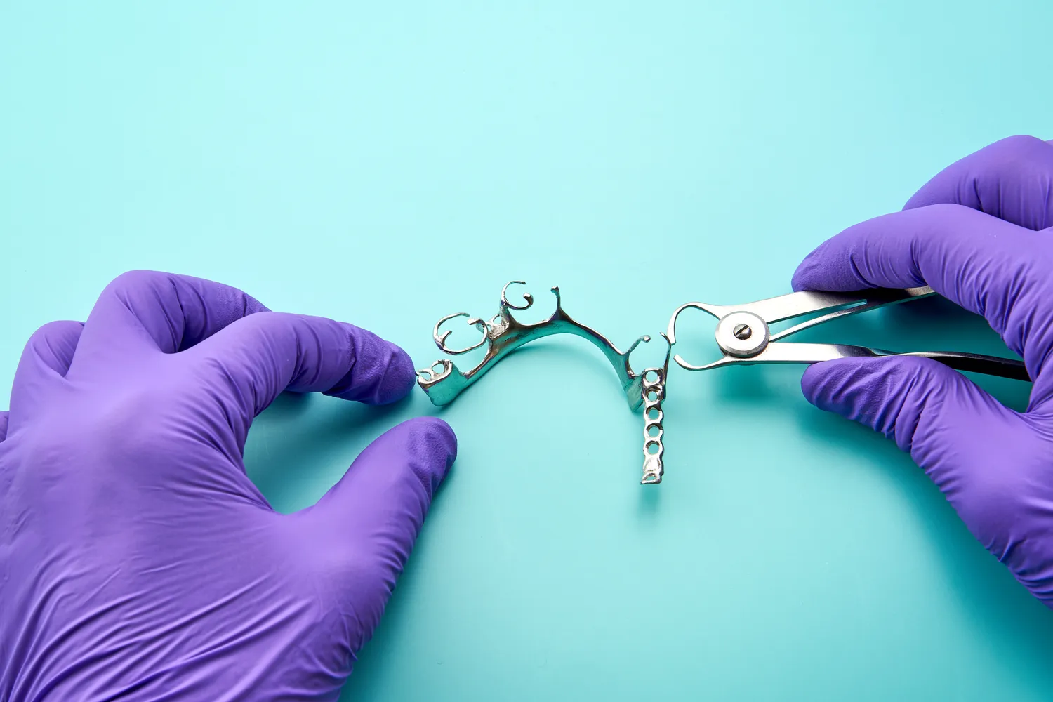 Ile trwa kanałowe leczenie zęba?