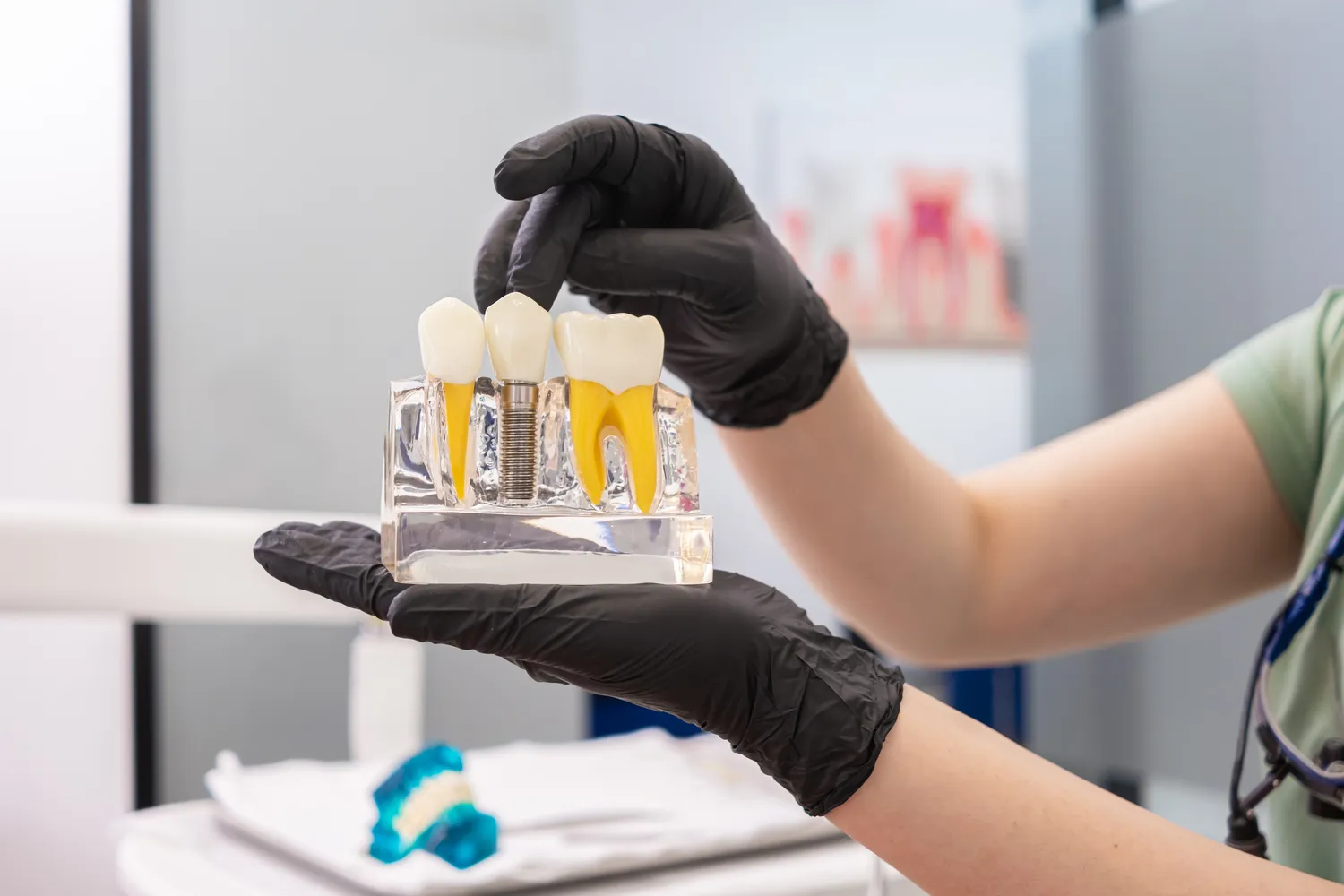 Ile trwa leczenie kanałowe jednego zęba?